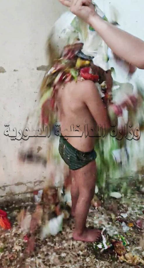 صور للطفل السوري خلال تعرضه للتعذيب